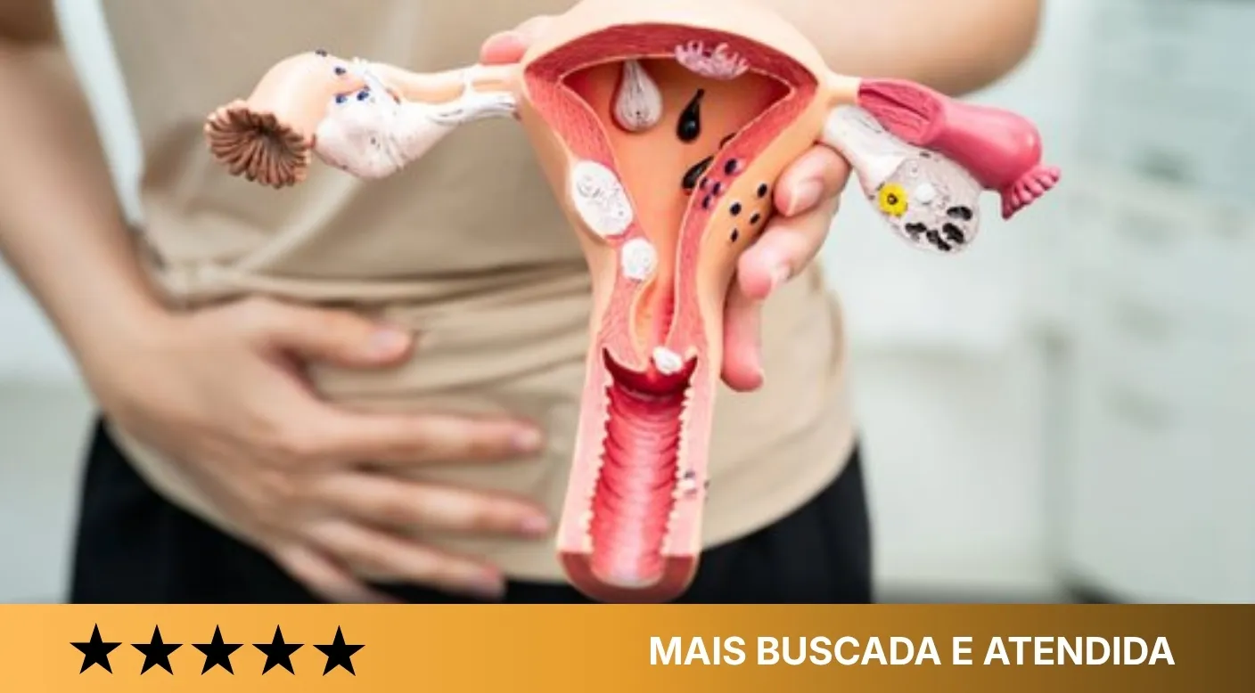 Endometriose (acompanhamento clínico)