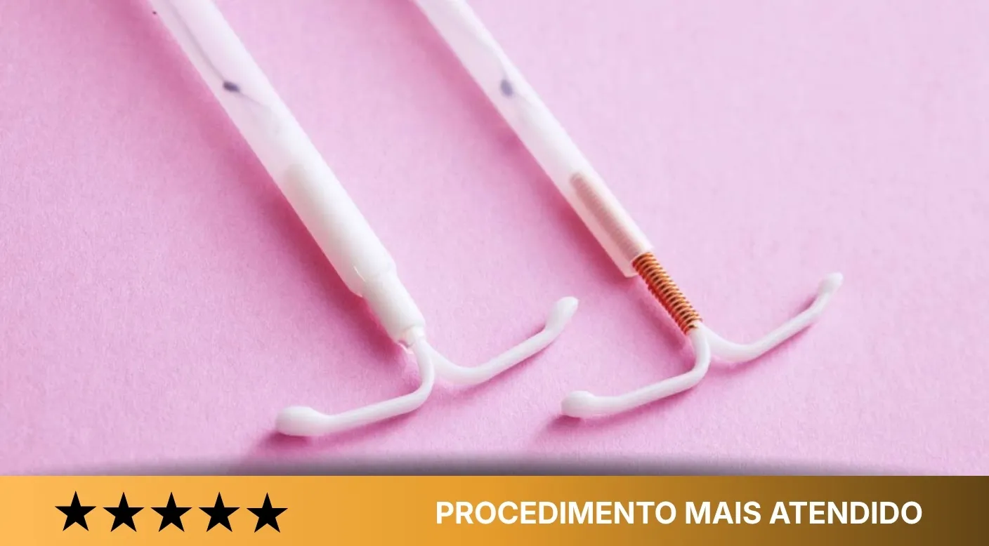 Inserção de DIU hormonal e não hormonal